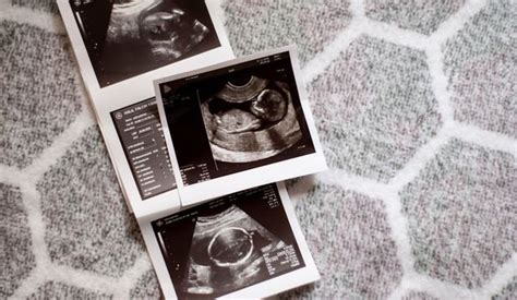 hamilelik ultrason terimleri
